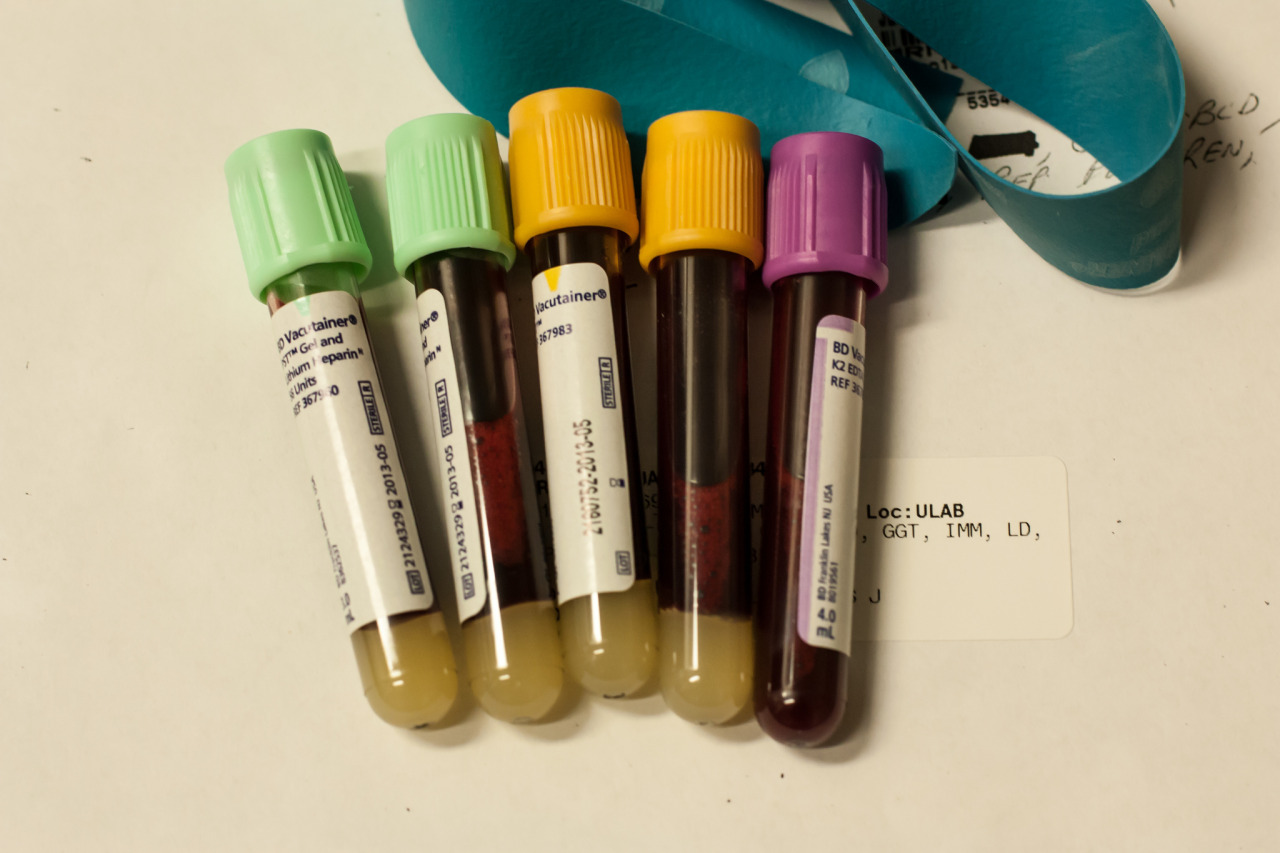 Blood sample